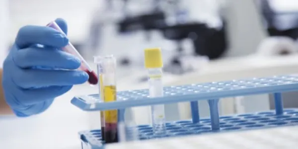 Air pollution & biomarkers